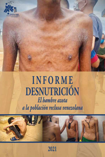 desnutricion